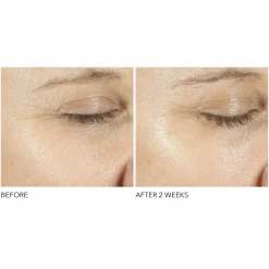 Dr. Dennis Gross Skincare Advanced Retinol + Ferulic Triple Correction Eye Serum