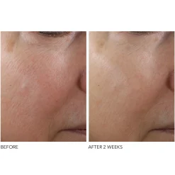 Dr. Dennis Gross Skincare Advanced Retinol and Ferulic Texture Renewal Serum