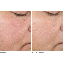 Dr. Dennis Gross Skincare Advanced Retinol and Ferulic Texture Renewal Serum