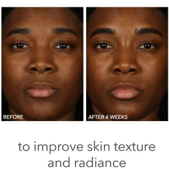 Dr. Dennis Gross Skincare Alpha Beta pH Balance Replenishing Cream