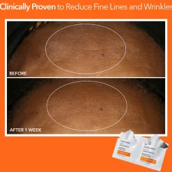 Dr Dennis Gross Skincare Alpha Beta Universal Daily Peel (Pack of 30)
