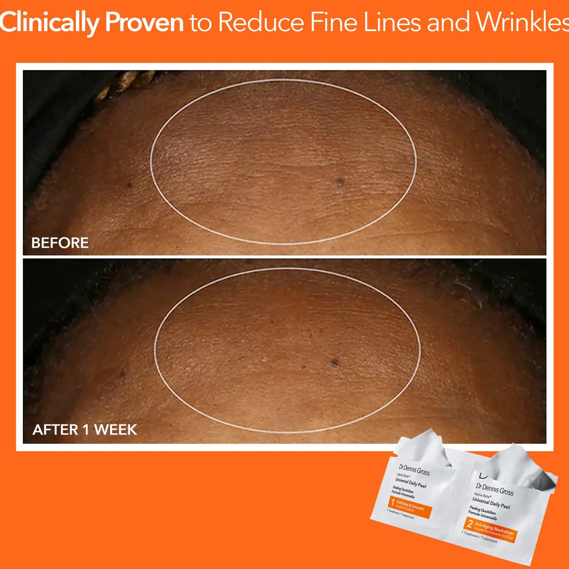 Dr Dennis Gross Skincare Alpha Beta Universal Daily Peel (Pack of 30)