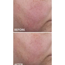 Dr Dennis Gross Skincare DermInfusions Blur and Repair Cream 50ml