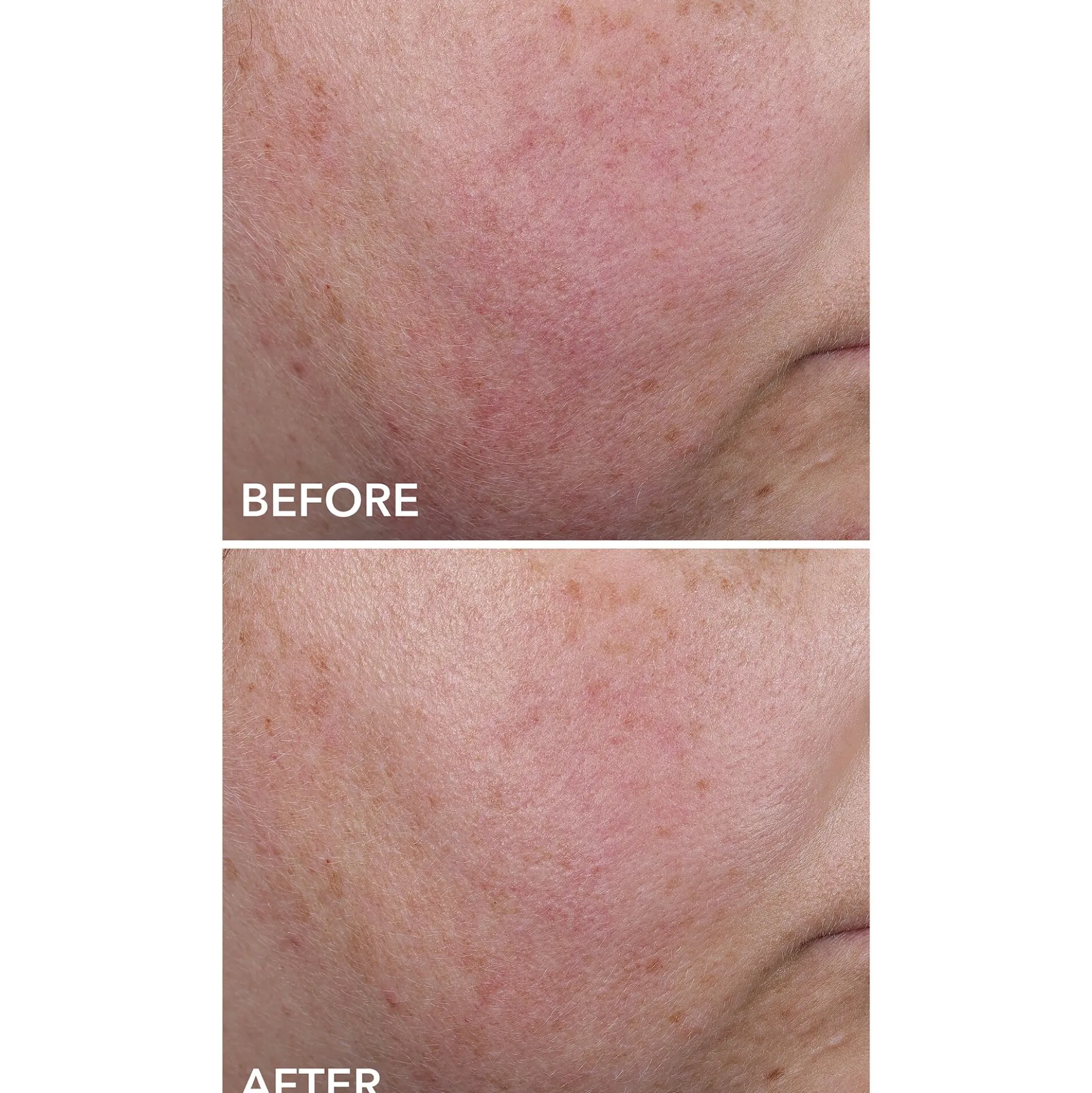 Dr Dennis Gross Skincare DermInfusions Blur and Repair Cream 50ml