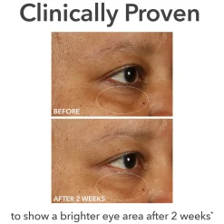Dr Dennis Gross Skincare DermInfusions Fill + Repair Eye Cream 15ml