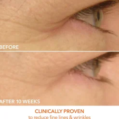 Dr Dennis Gross Skincare DRx SpectraLite EyeCare Max Pro Device