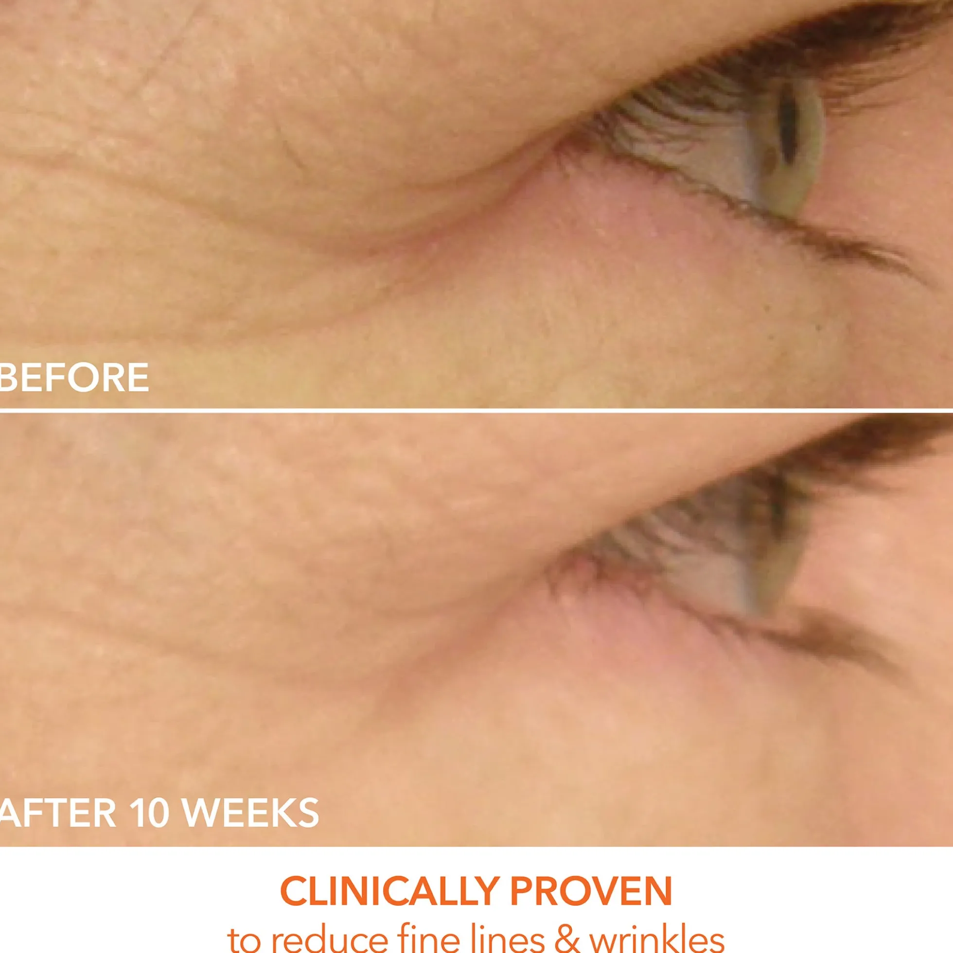 Dr Dennis Gross Skincare DRx SpectraLite EyeCare Max Pro Device