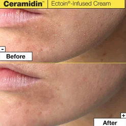 Dr.Jart+ Ceramidin Ectoin-Infused Cream 50ml