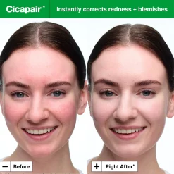 Dr.Jart+ Cicapair™ Soothing Color Correcting Treatment SPF 30 15ml