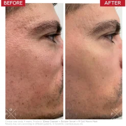 Dr. LEVY Switzerland Booster Serum 10ml