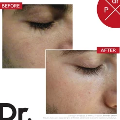 Dr. LEVY Switzerland Booster Serum 10ml