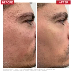 Dr. LEVY Switzerland Booster Serum 30ml