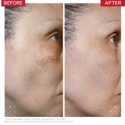 Dr. LEVY Switzerland Radical3 Reboot Pro Peel 50ml