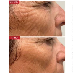 Dr. LEVY Switzerland The Contour Pro