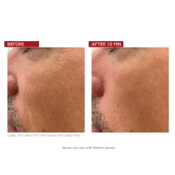 Dr. LEVY Switzerland The Contour Pro