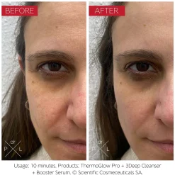 Dr. LEVY Switzerland The ThermoGlow Pro Device