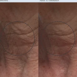 Dr. Loretta Resurfacing Enzyme Polish with Niacinamide 50ml