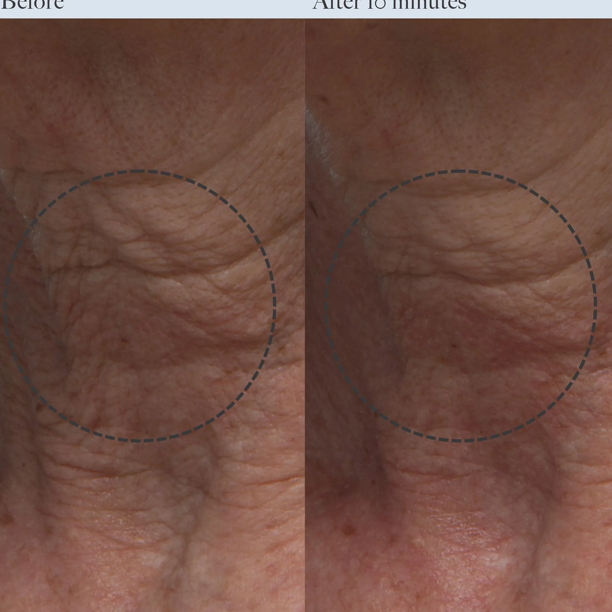Dr. Loretta Resurfacing Enzyme Polish with Niacinamide 50ml