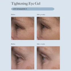 Dr. Loretta Tightening Eye Gel 20ml
