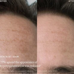 Emma Lewisham Skin Reset Face Serum 30ml