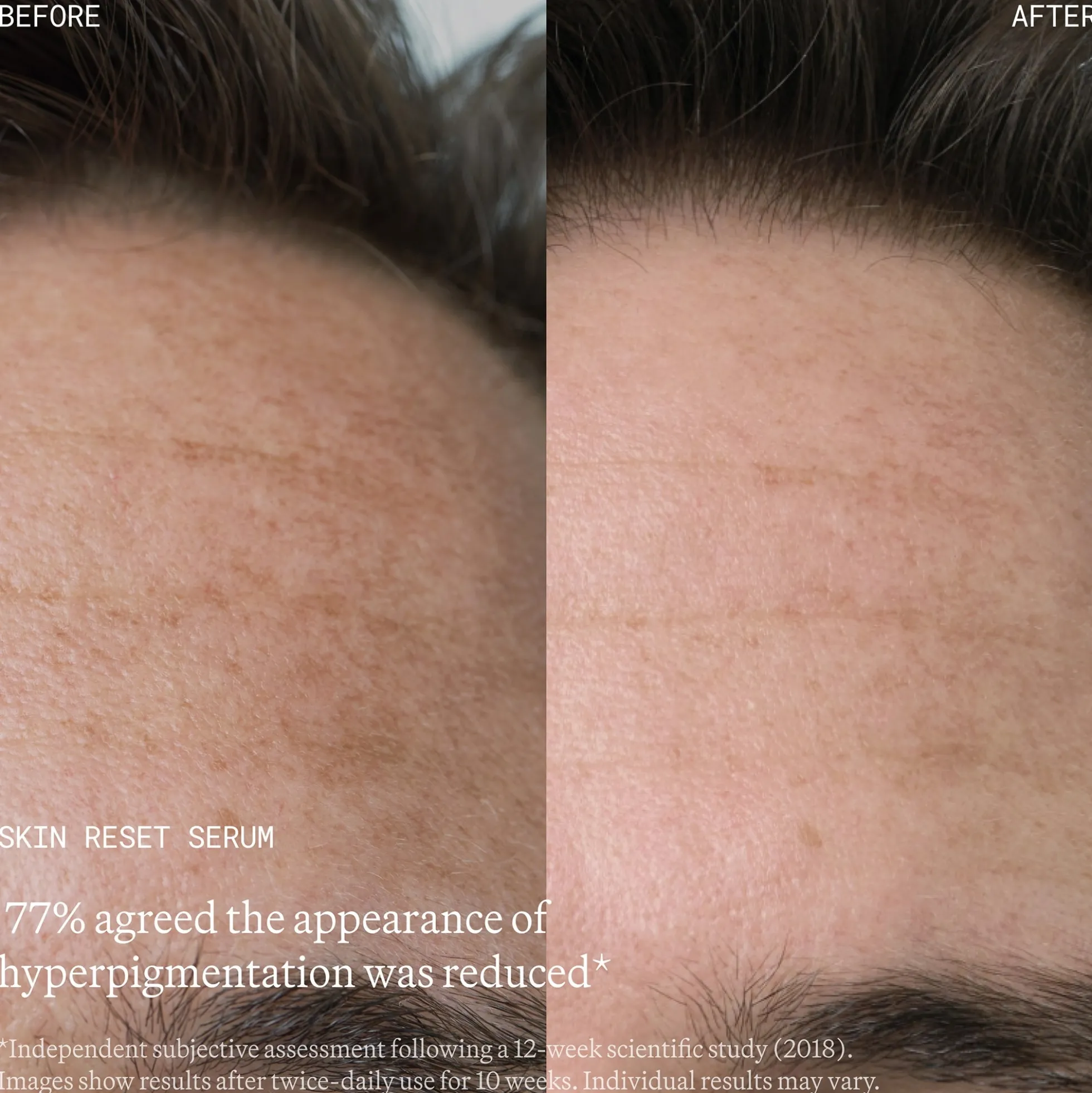 Emma Lewisham Skin Reset Face Serum 30ml