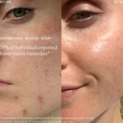 Emma Lewisham Supernatural Blemish Serum 60ml