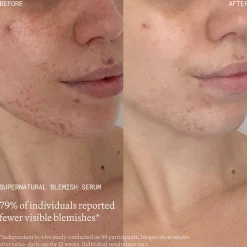 Emma Lewisham Supernatural Blemish Serum 60ml