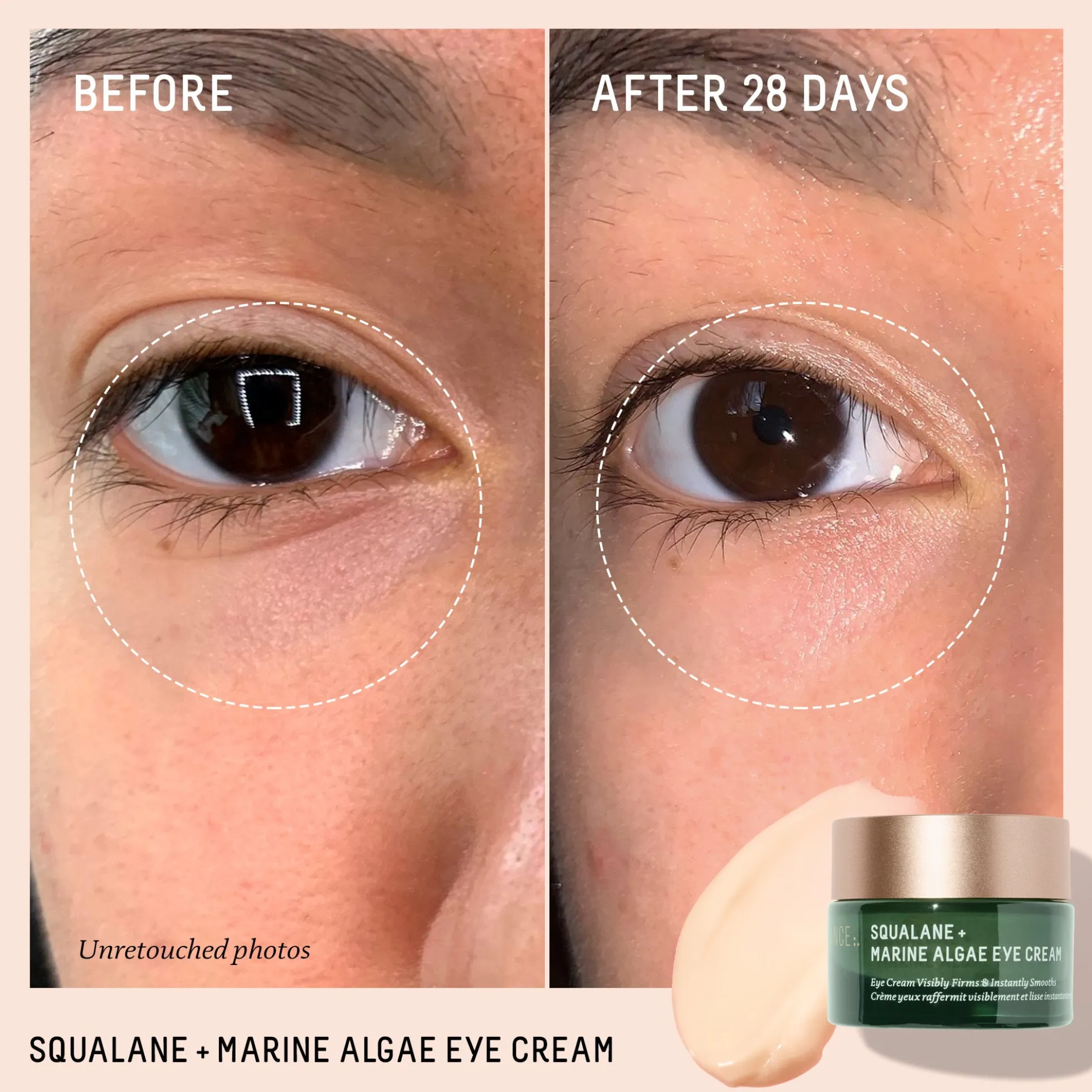 Eye Revival Duo (Worth £90)
