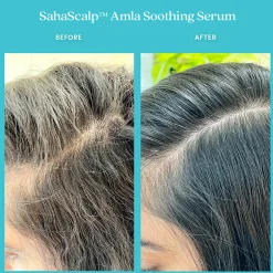 Fable & Mane Sahascalp Amla Soothing Serum