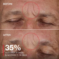 FaceGym Pro - Electrical Muscle Stimulation Device