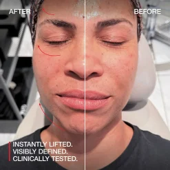 FaceGym Pro - Electrical Muscle Stimulation Device
