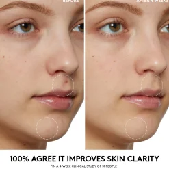 Fenty Skin Cherry Dub Pore Purify’R Gel Cleanser 190ml
