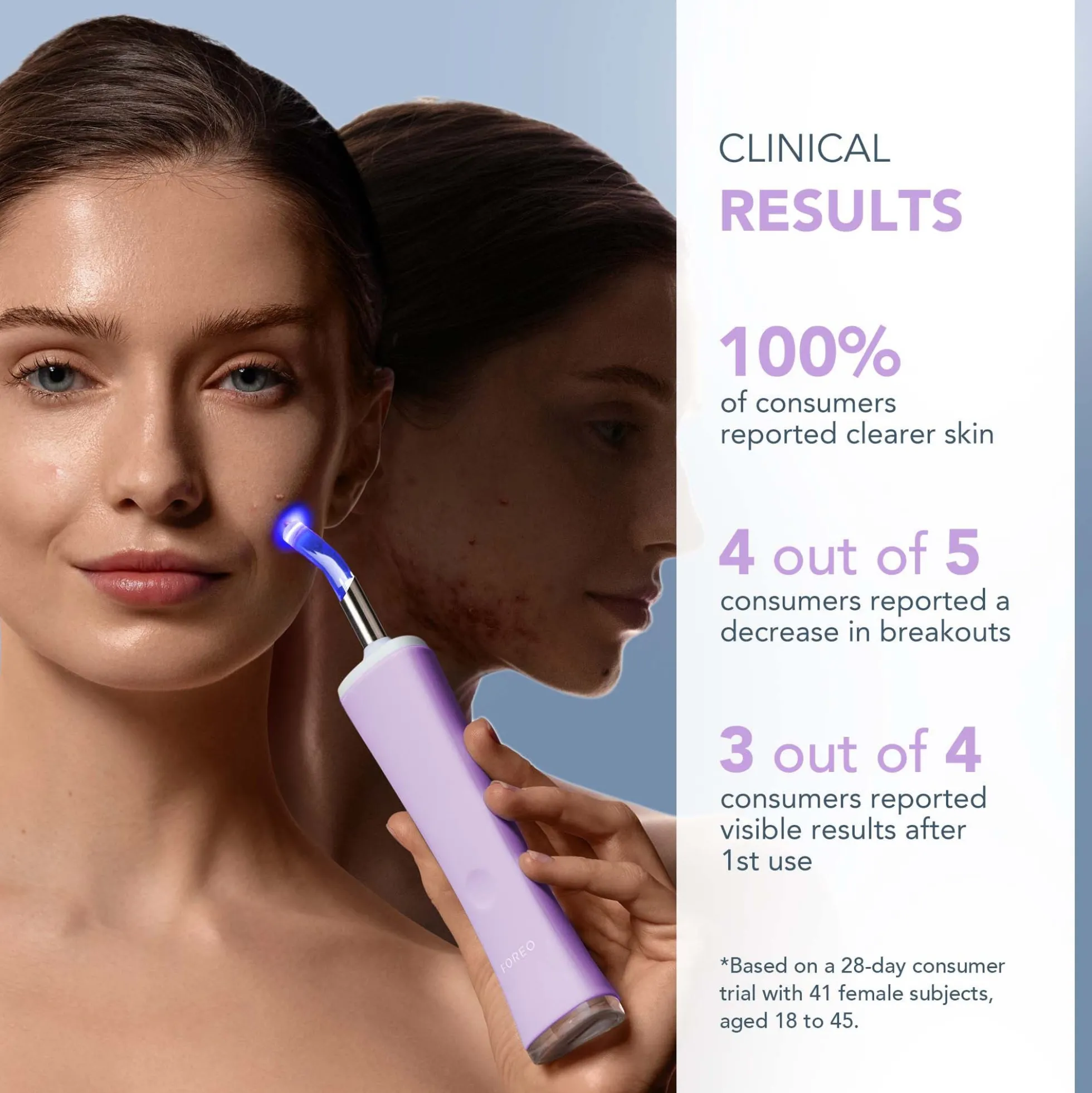 FOREO ESPADA 2 plus Device - Lavender