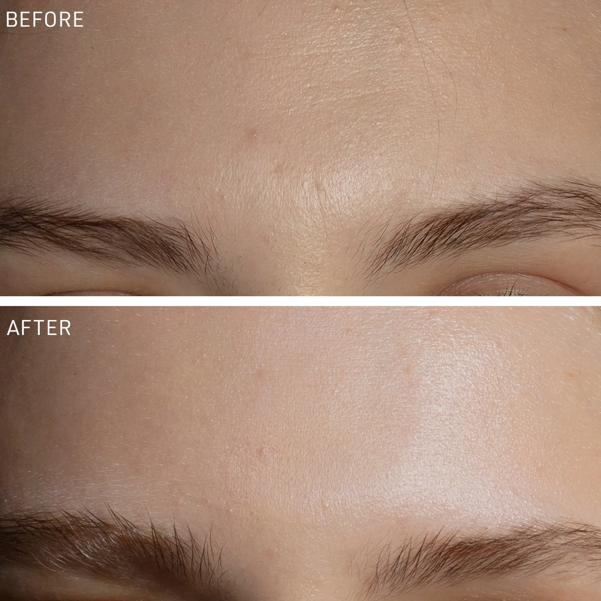 FOREO FAQ Anti-Wrinkle Patches - Forehead