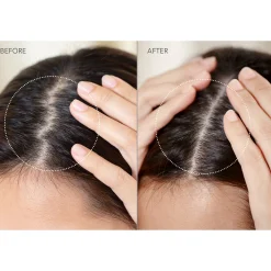 FOREO LUNA 4 hair