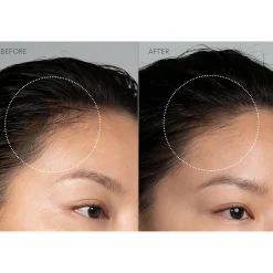 FOREO LUNA 4 hair