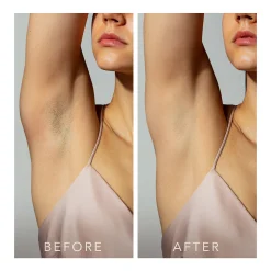 FOREO PEACH 2 Device - Peach