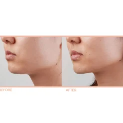 FOREO SUPERCHARGED Triple-Action Firming Serum 30ml