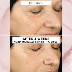 Forget the Filler Oil-Free Skin-Plumping Line Smoothing Perfecting Cream 50g