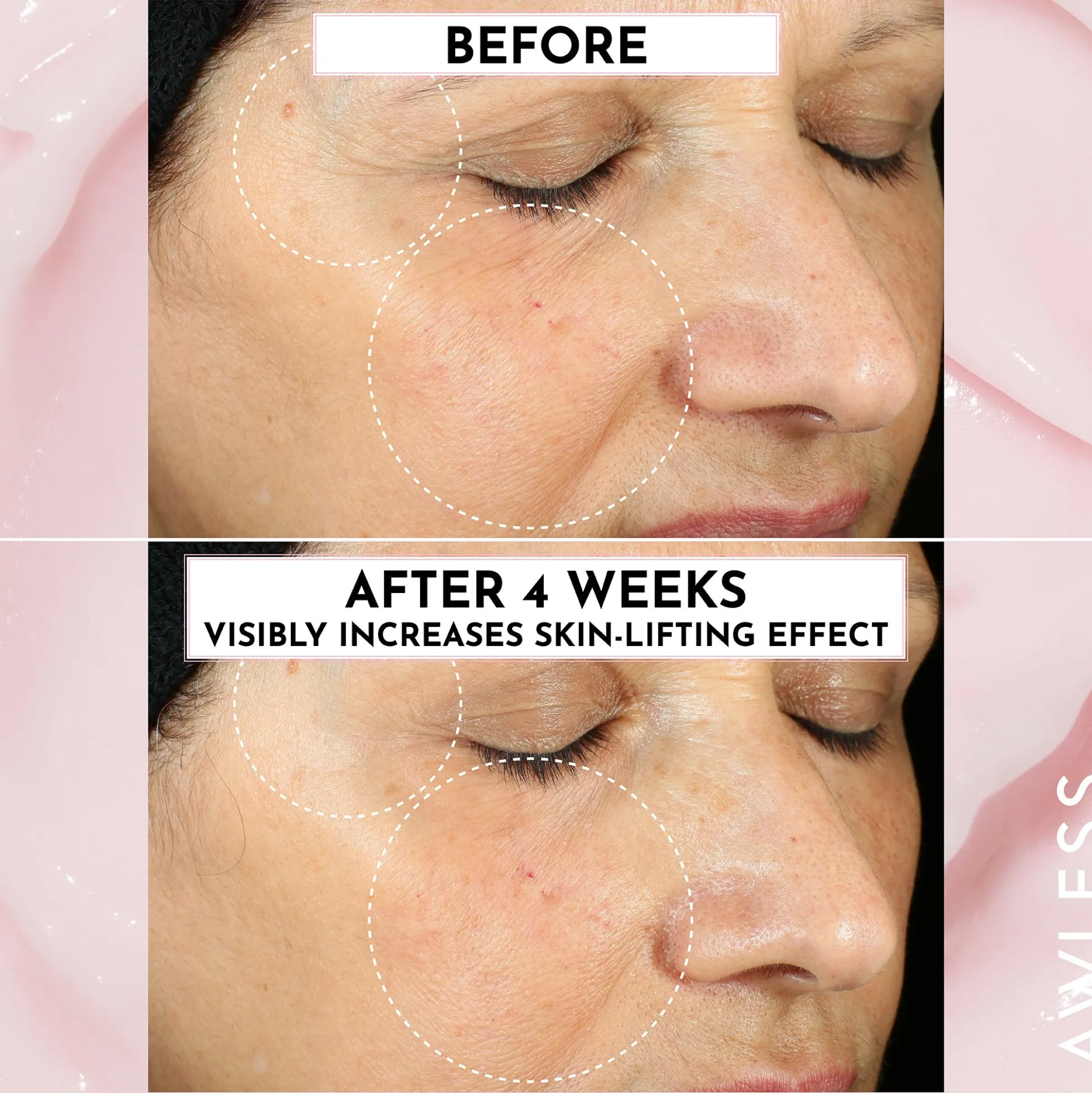 Forget the Filler Oil-Free Skin-Plumping Line Smoothing Perfecting Cream 50g