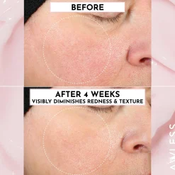 Forget the Filler Oil-Free Skin-Plumping Line Smoothing Perfecting Cream 50g