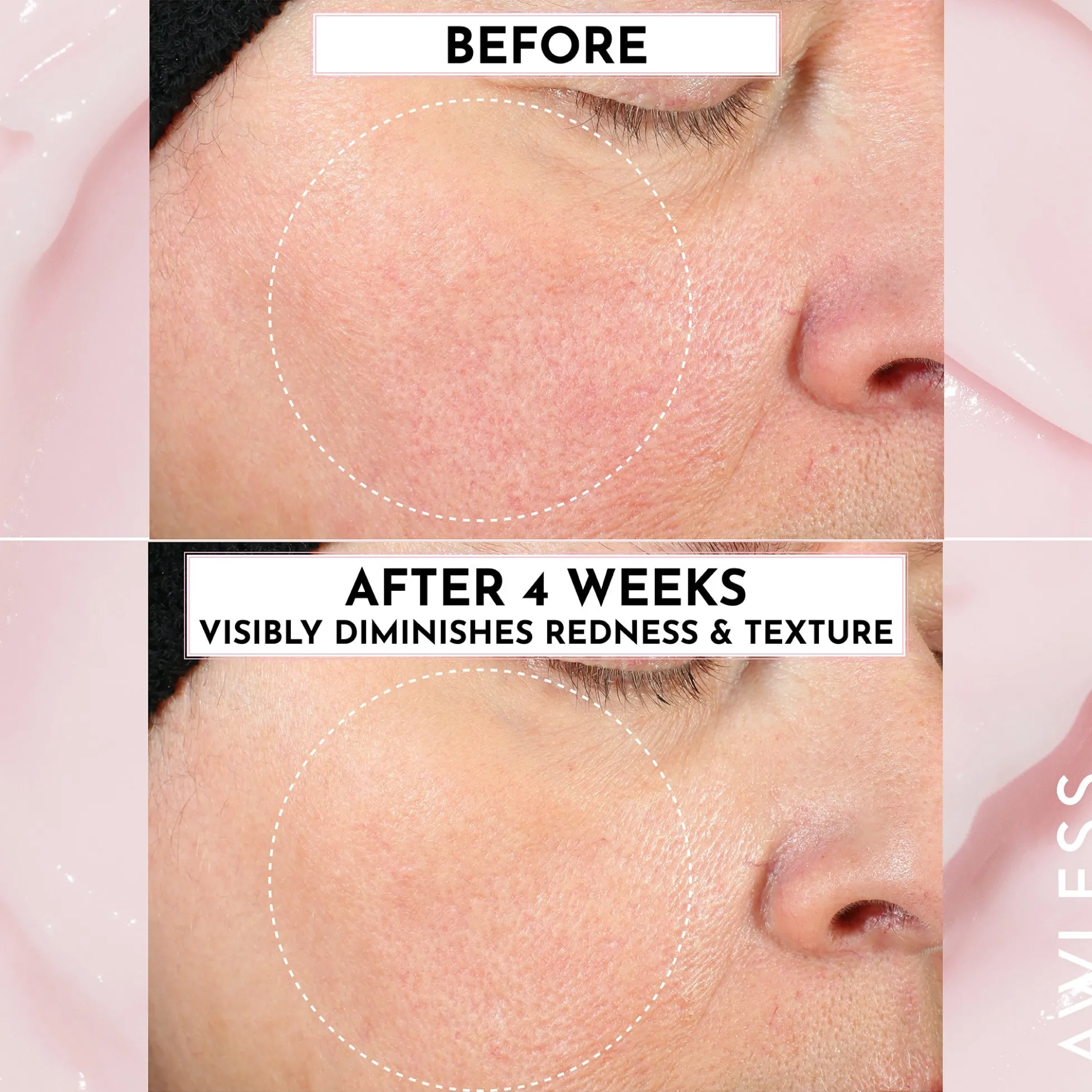 Forget the Filler Oil-Free Skin-Plumping Line Smoothing Perfecting Cream 50g