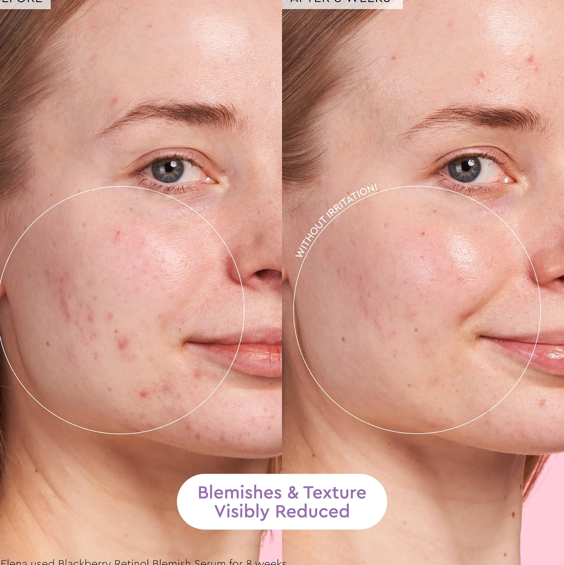 Glow Recipe Blackberry Retinol Blemish Serum 30ml
