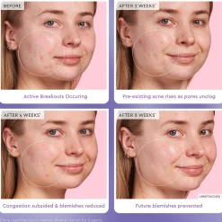 Glow Recipe Blackberry Retinol Blemish Serum 30ml