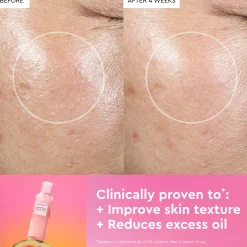 Glow Recipe Limited Edition Pride Watermelon Glow PHA + BHA Pore Tight Toner 150ml