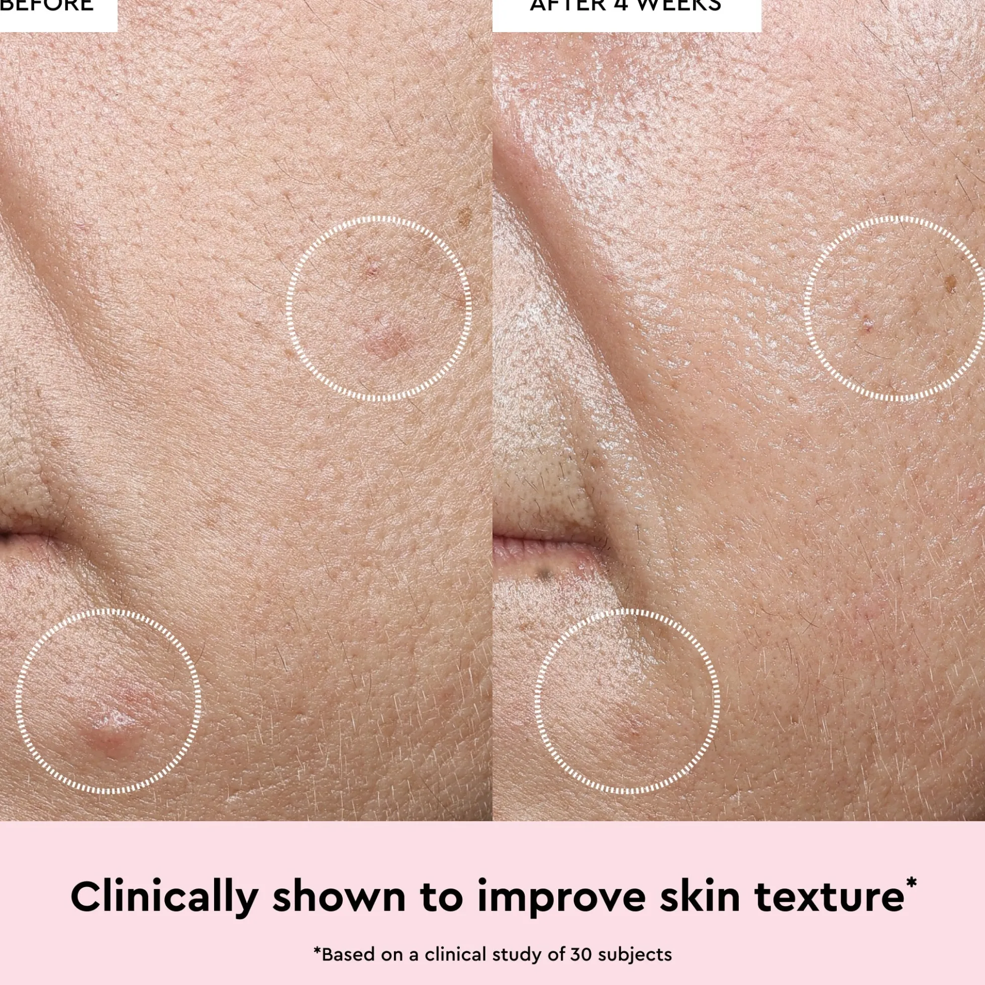 Glow Recipe Watermelon Glow Niacinamide Dew Drops 15ml