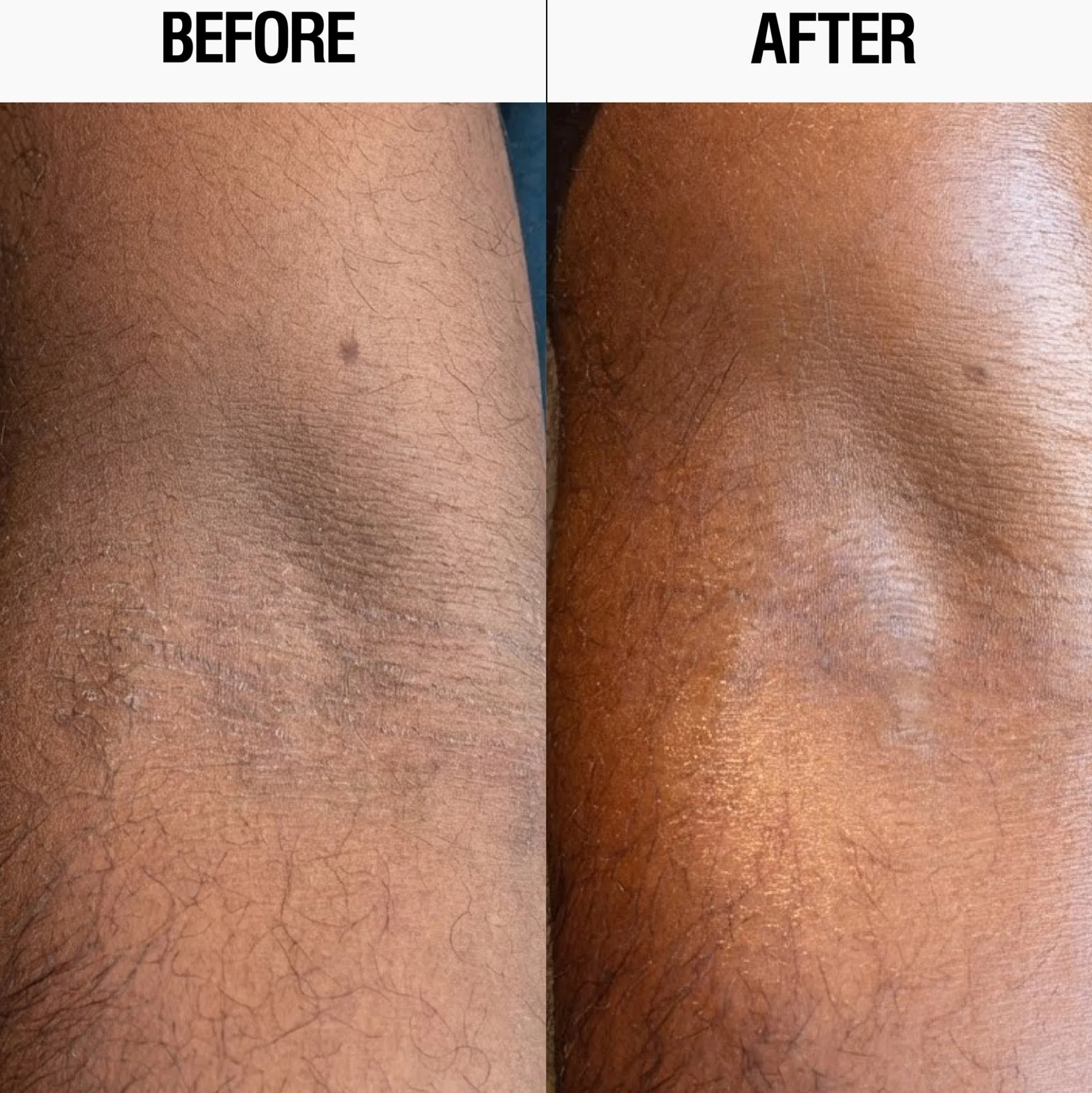 Grown Alchemist Resurfacing Targeted Body Lotion 300ml