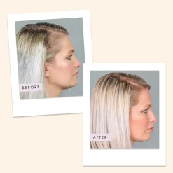 Hair Gain Capsules - 60 Capsules