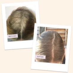 Hair Gain Capsules - 60 Capsules