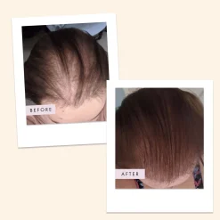 Hair Gain Capsules - 60 Capsules